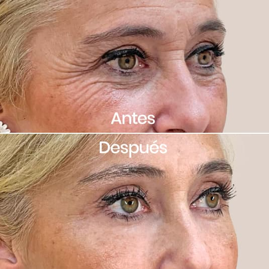 Crema Antiarrugas Reafirmante con Ácido Hialurónico y Colágeno + Aceite Rejuvenecedor de Regalo